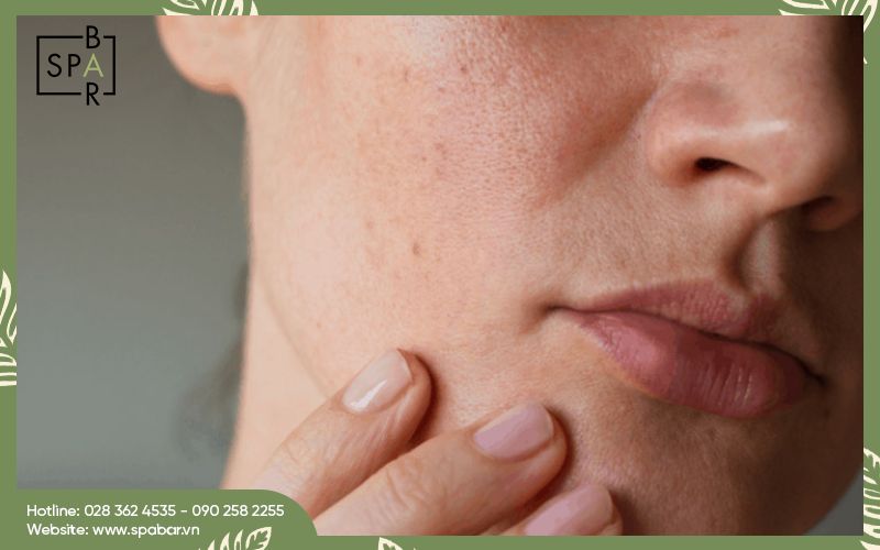 ba bau co nen di spa cham soc da mat 2 Sự thay đổi của làn da trong thai kỳ